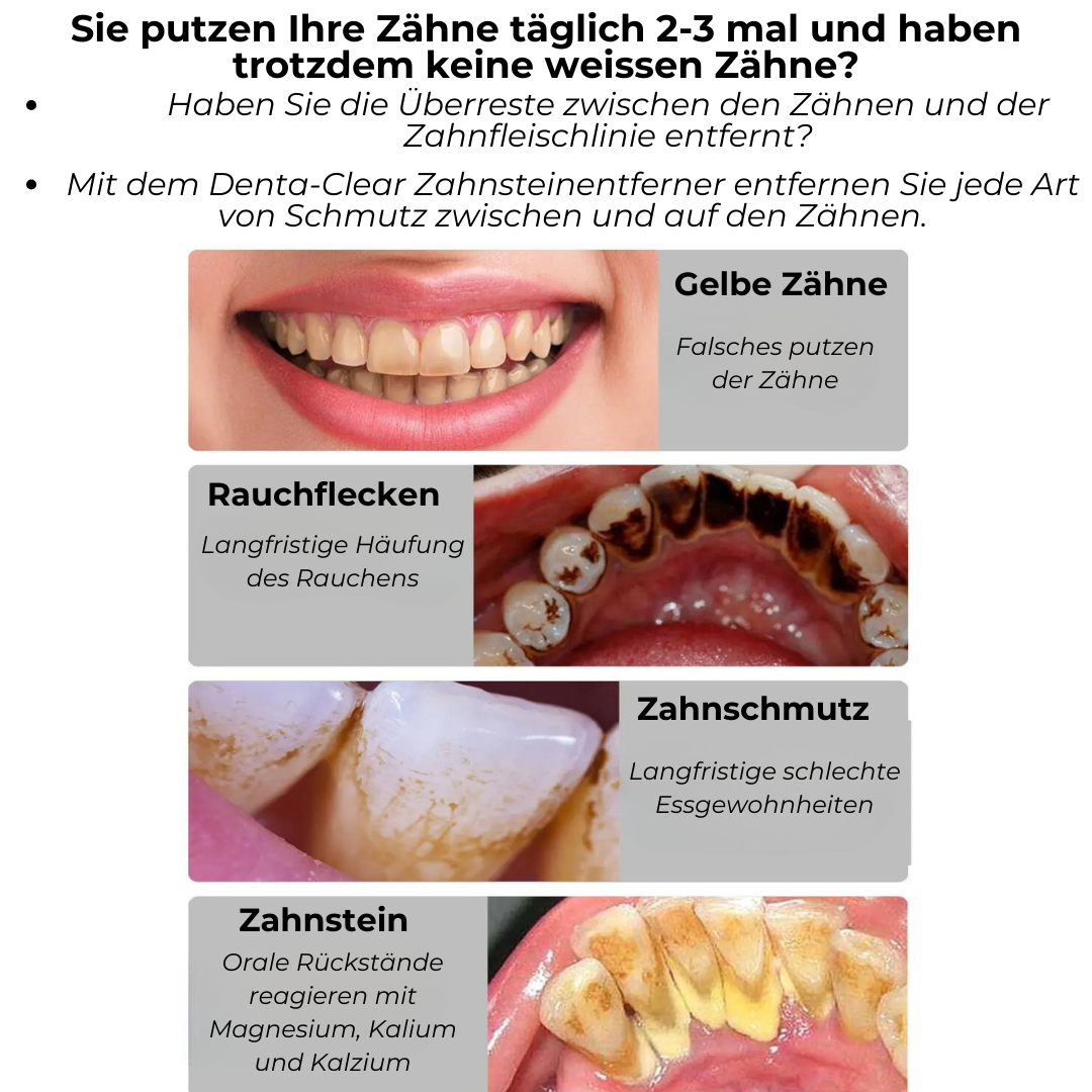 DentaClear-Zahnsteinentferner für ein strahlend weisses Lächeln